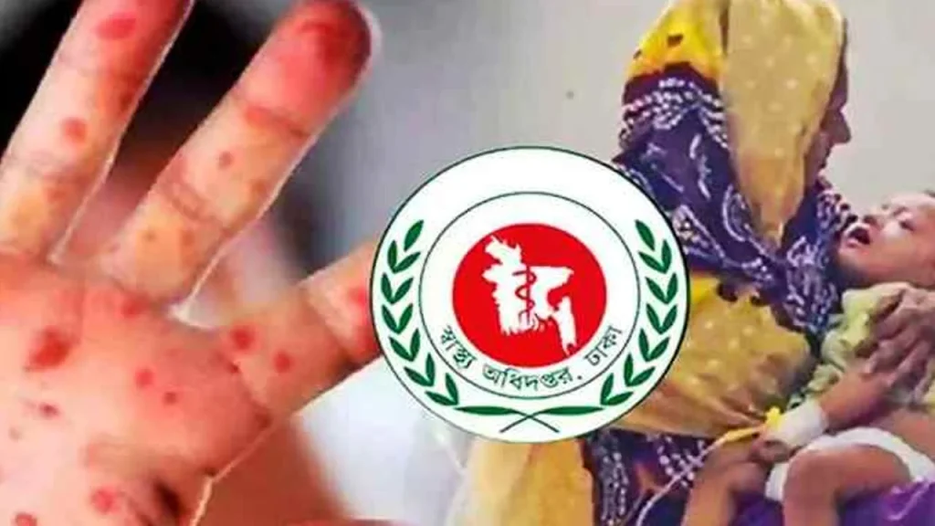 প্রথম সমাচার Prothom Somachar হামের প্রাদুর্ভাবে আক্রান্ত শিশুদের চিকিৎসা বা টিকাদান কার্যক্রমের একটি চিত্র।