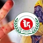 প্রথম সমাচার Prothom Somachar হামের প্রাদুর্ভাবে আক্রান্ত শিশুদের চিকিৎসা বা টিকাদান কার্যক্রমের একটি চিত্র।